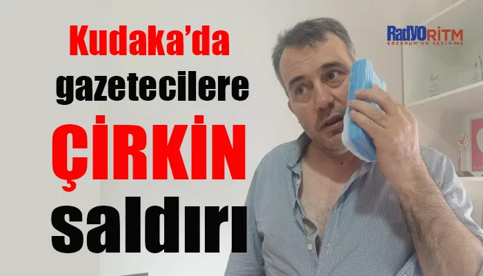 Kudaka’da gazetecilere çirkin saldırı